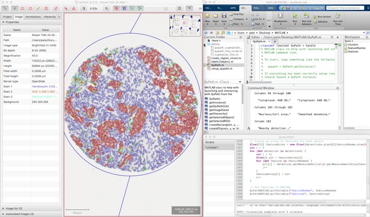 Running k-means clustering using MATLAB and QuPath