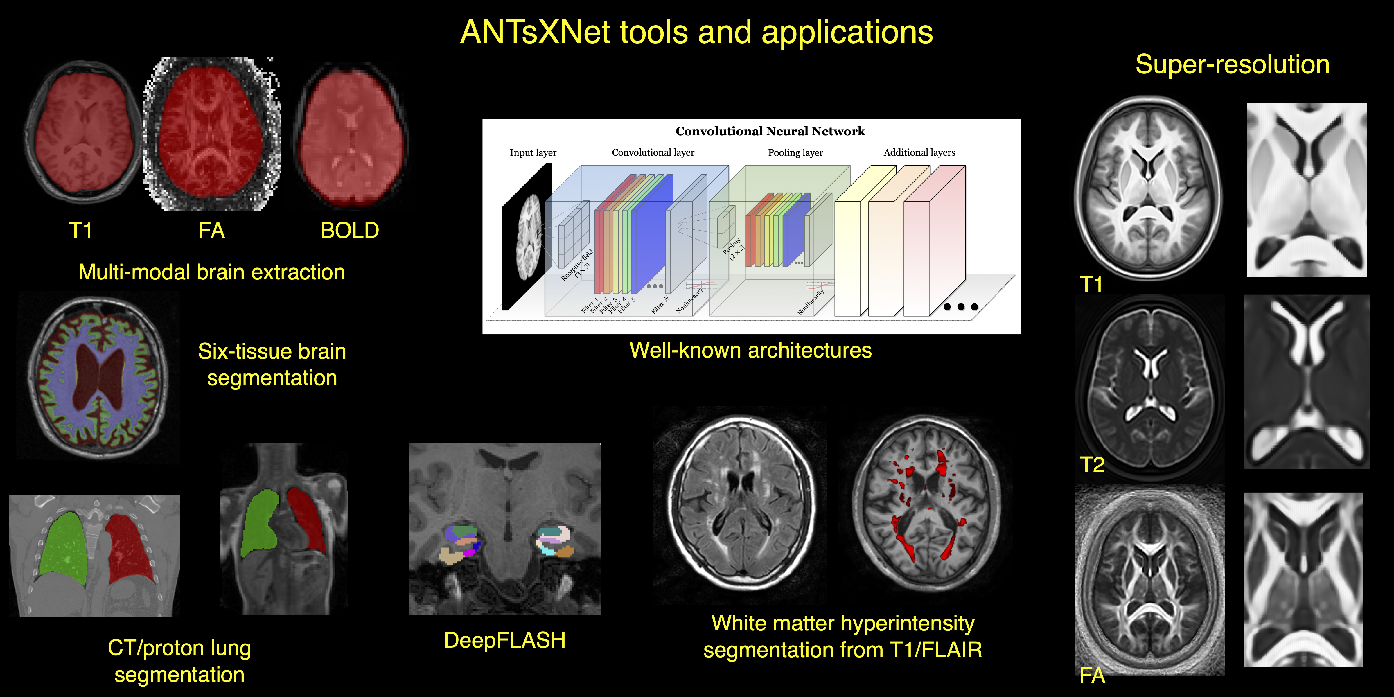 coreANTsXNetTools.png