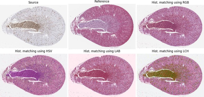 Rat-Kidney_histogram-matching.jpg