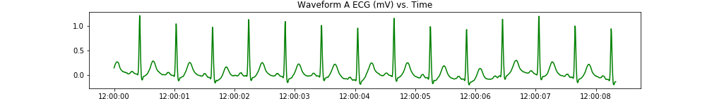 waveform_a_ecg.png