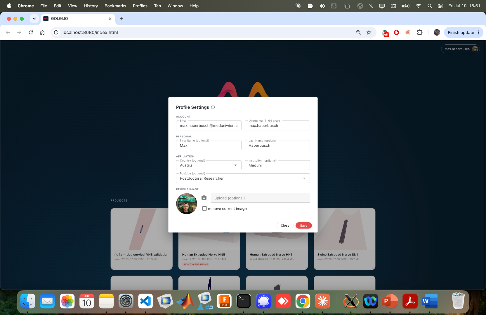 Profile settings dialog