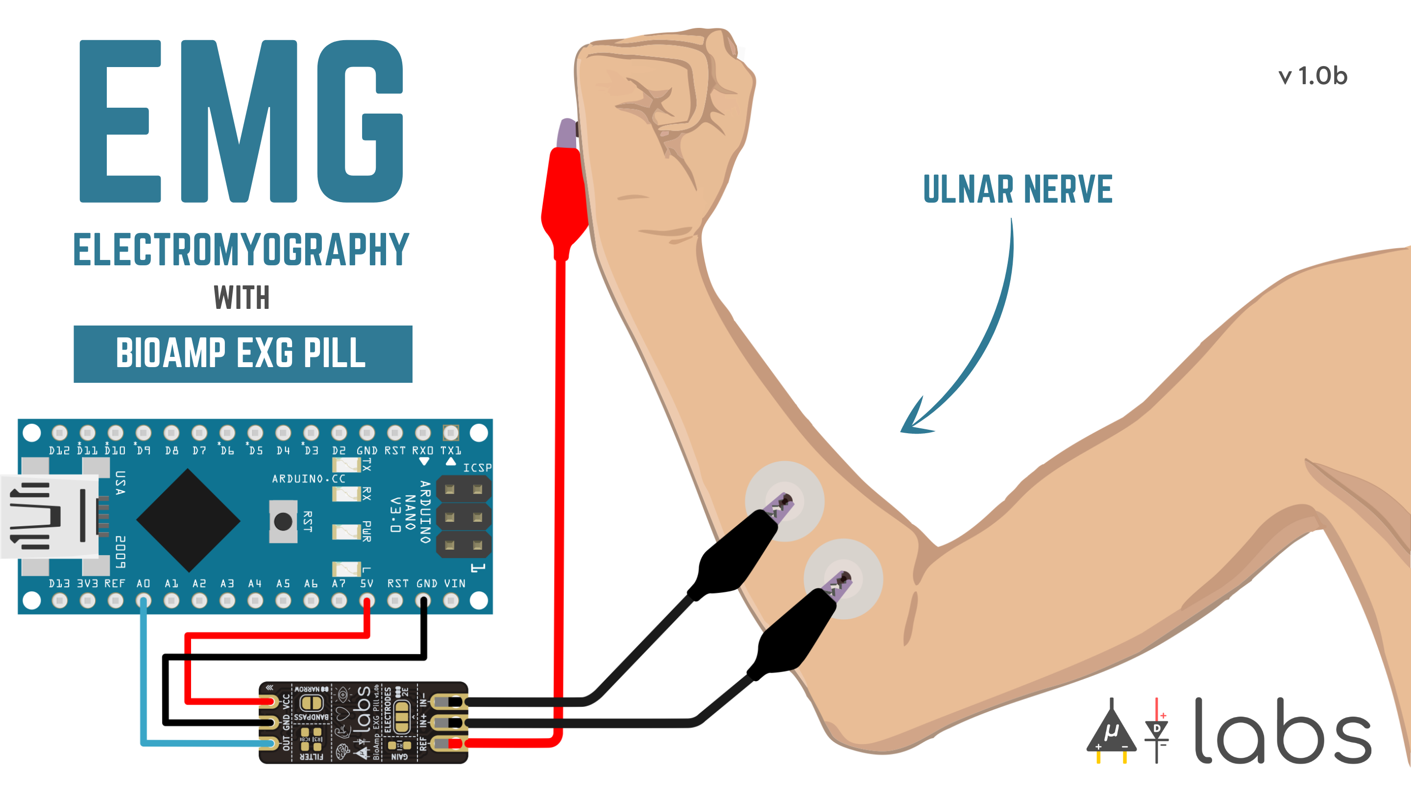 Electromyography.png