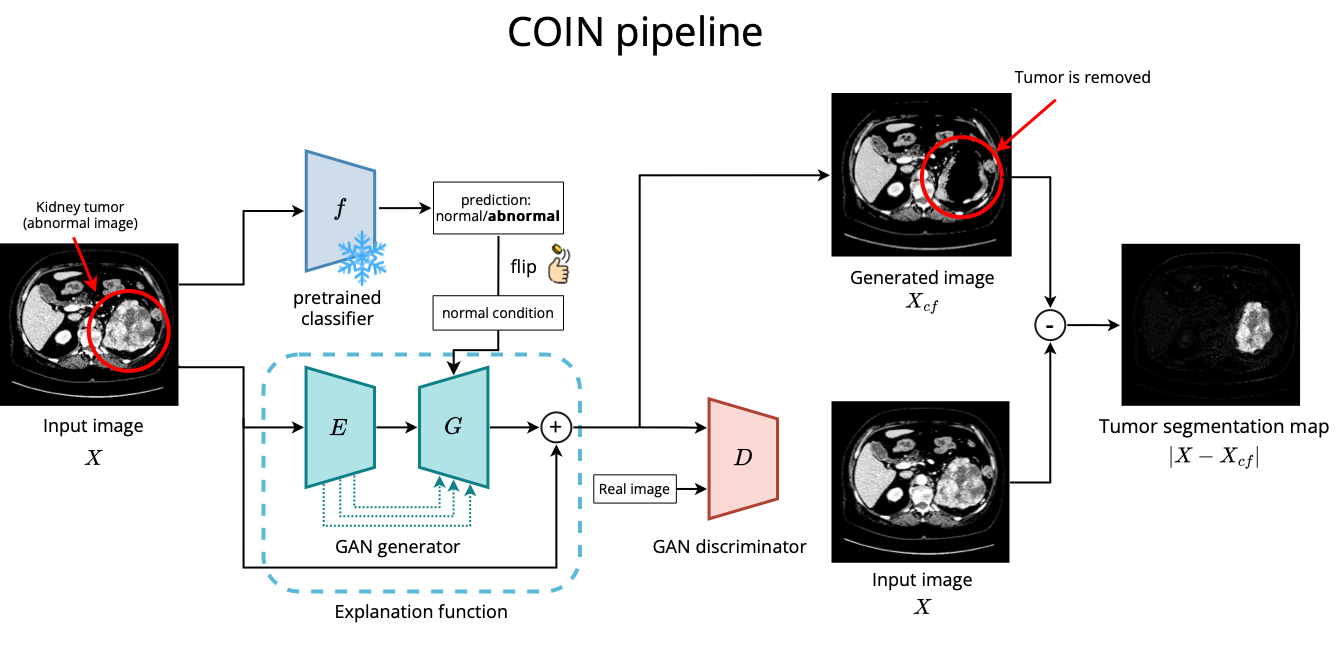 inference_pipeline.png