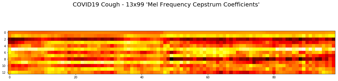 COVID19_Cough_Mel_Frequency_Cepstrum_Coefficients.png