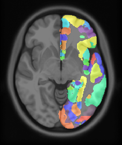 julich-brain-l-native-mni152.png