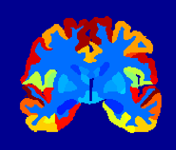 brain-regions.png