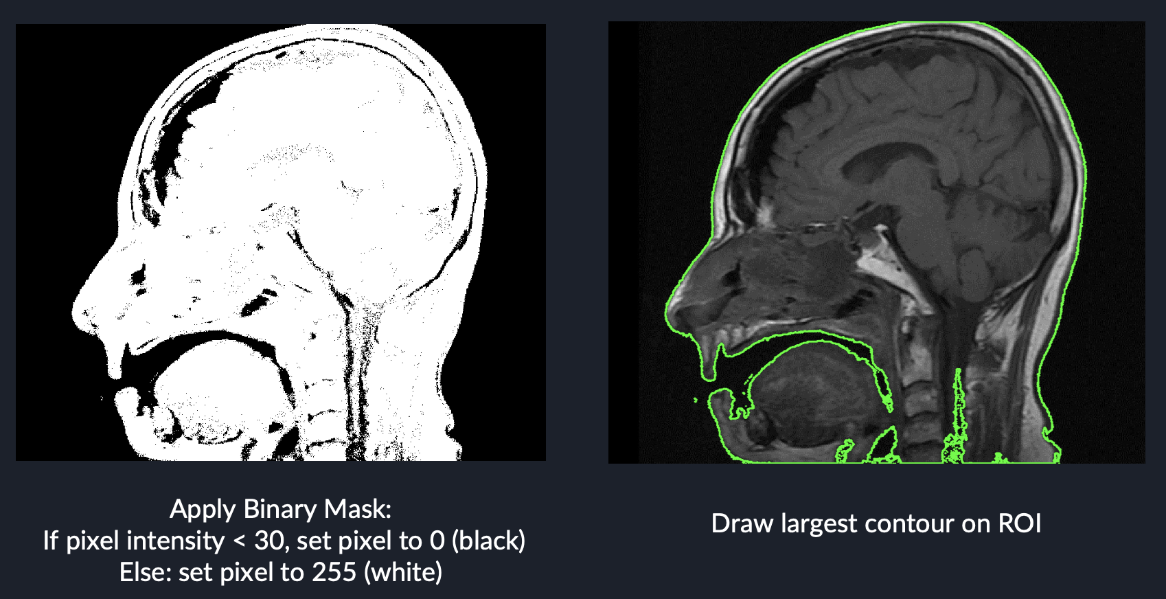 MRI_Mask_DrawCont.png