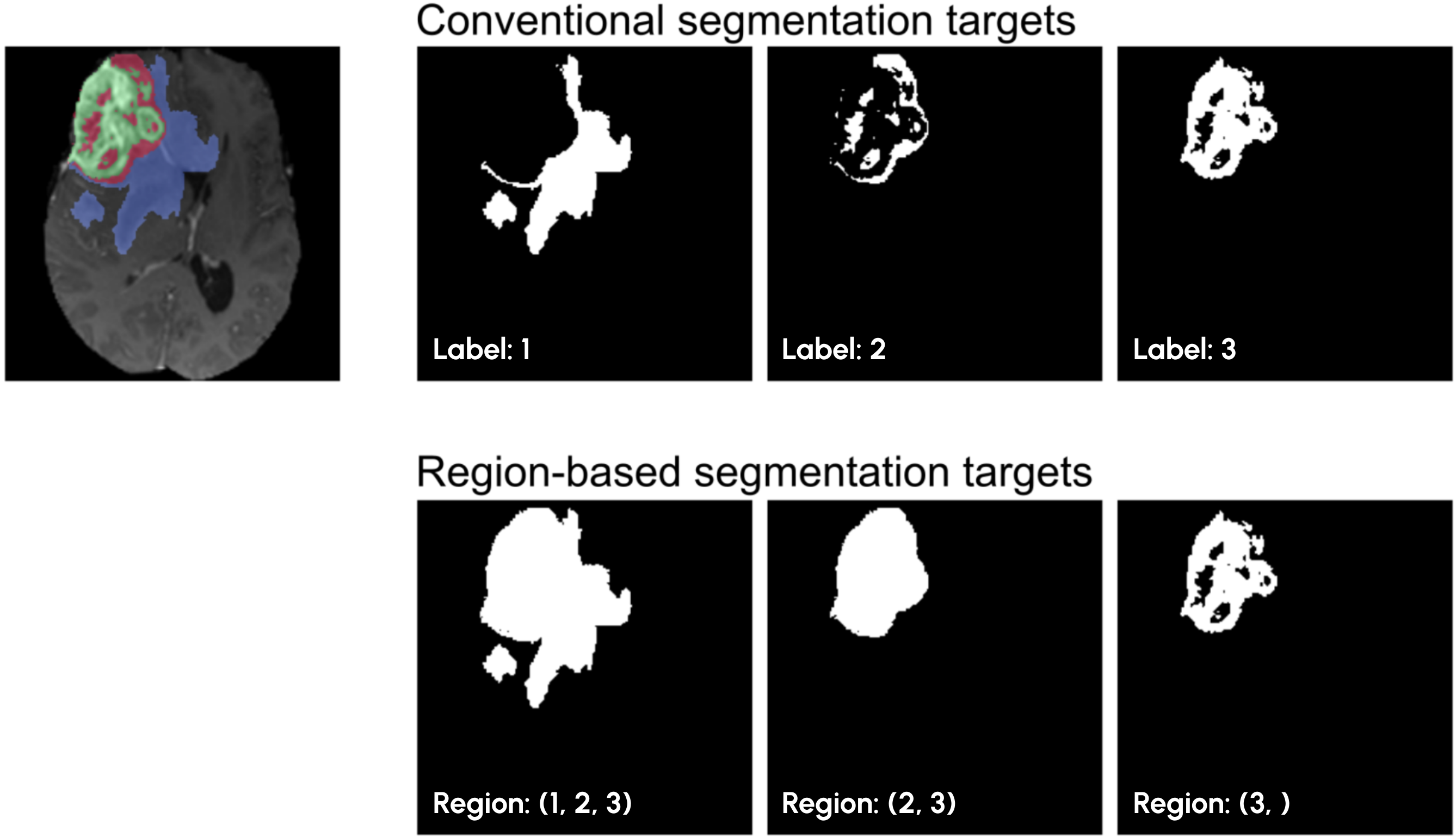 regions_vs_labels.png