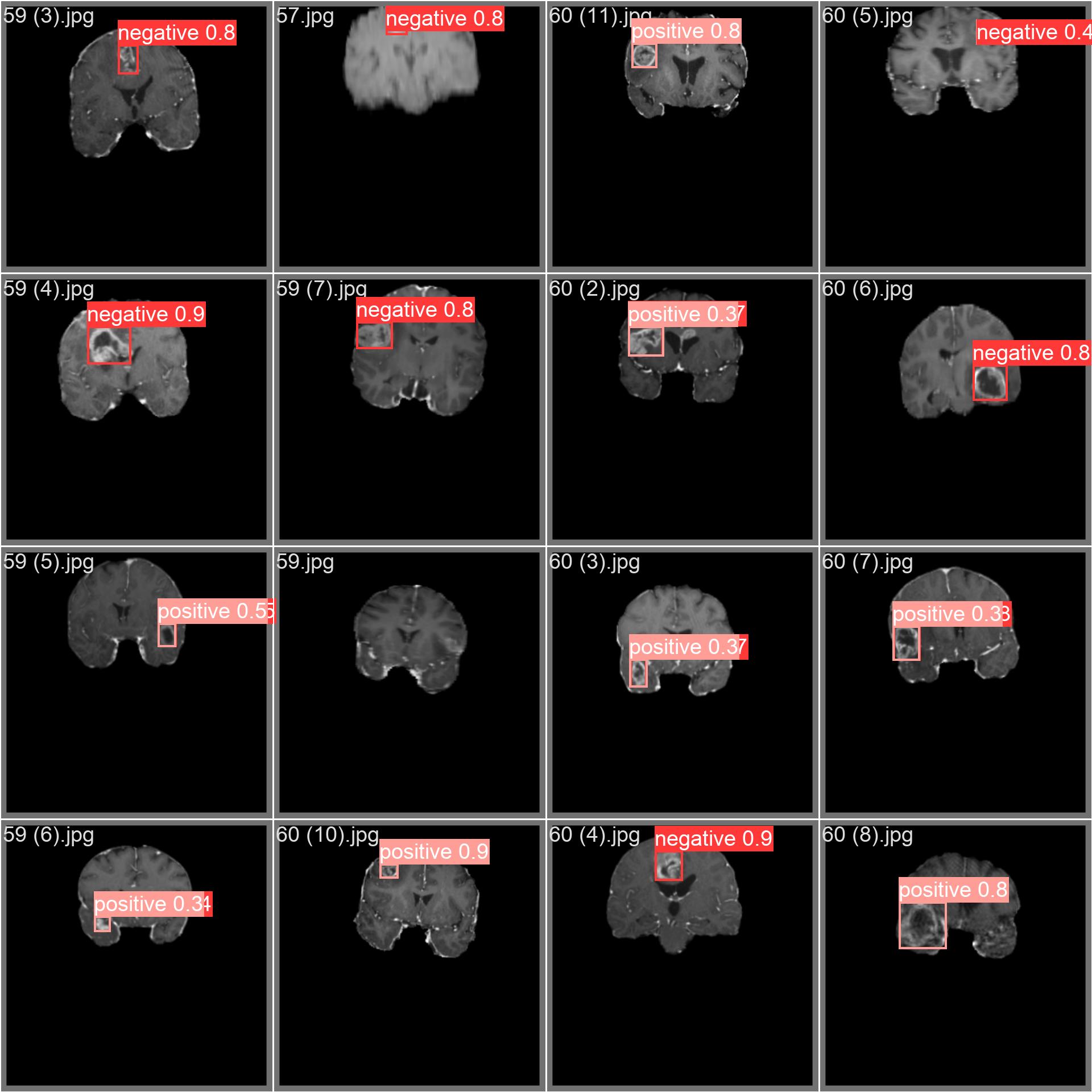 脳腫瘍データセットのサンプル画像