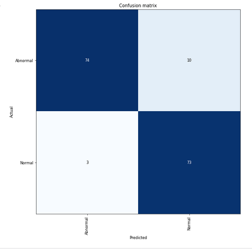 resnet34-confusion-matrix.PNG