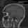 Rothermal
