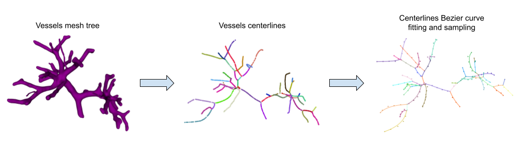 vessel_processing.png