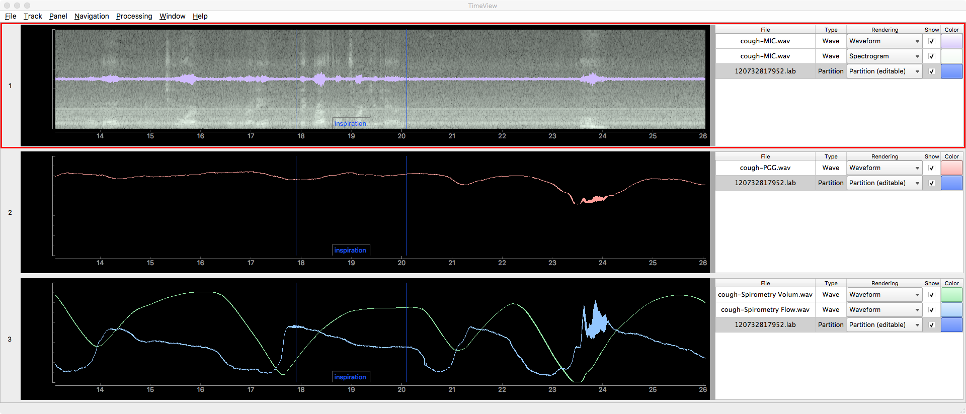 TimeView.png