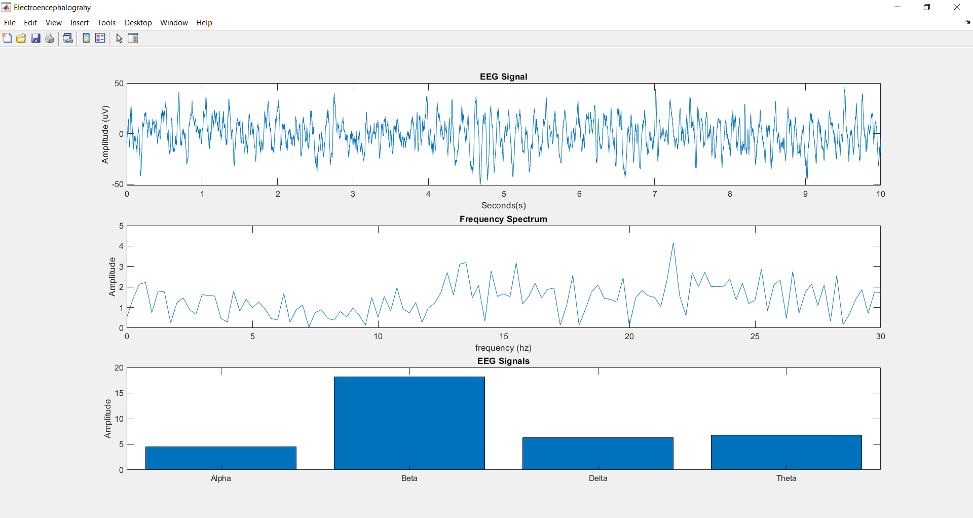 EEG-chart.png