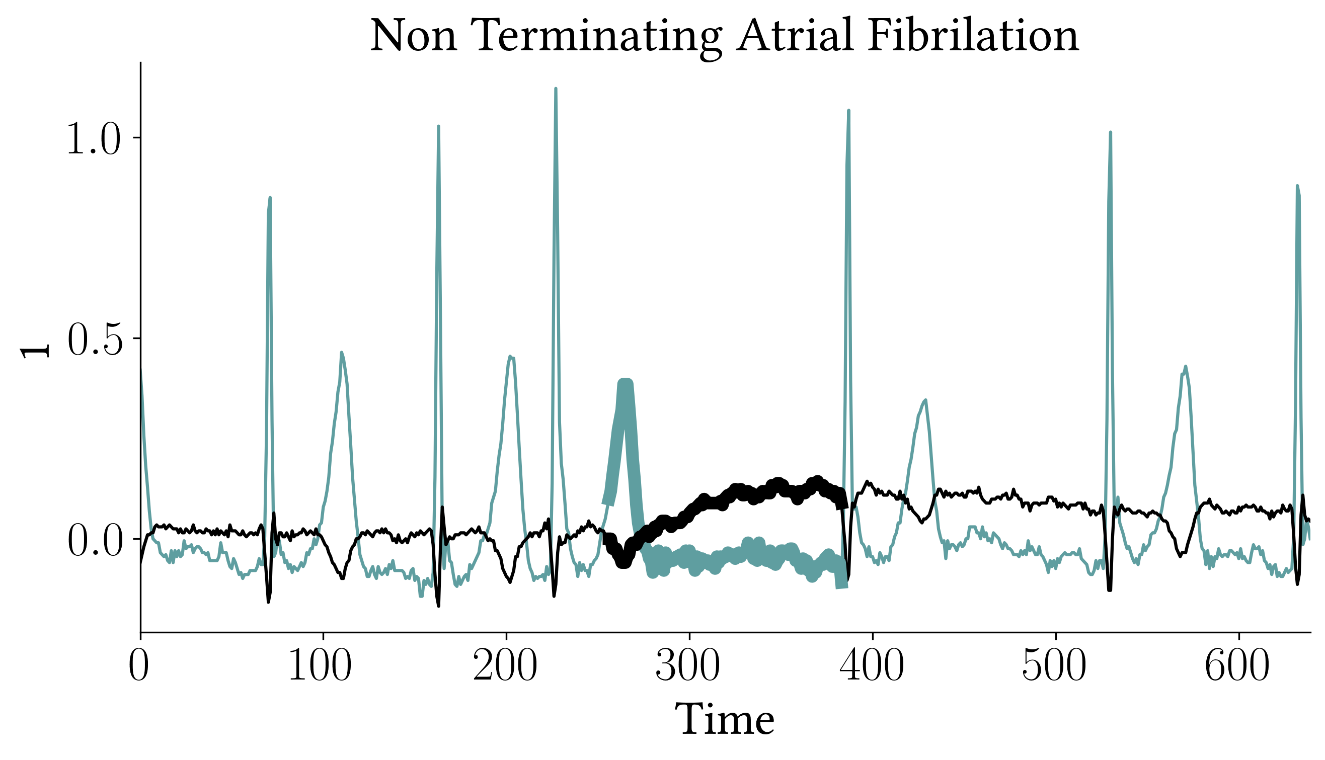 non_terminating_atrial_fibrilation.png