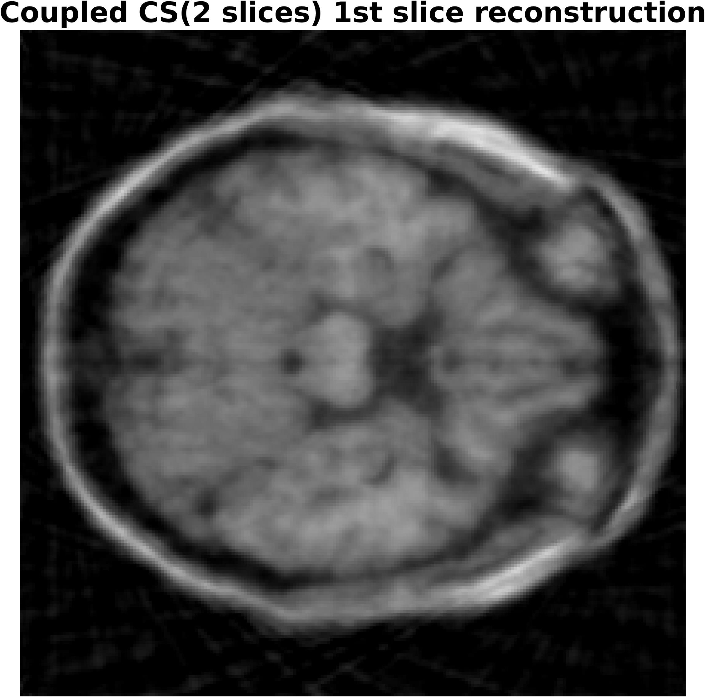 cs2slice1.jpg