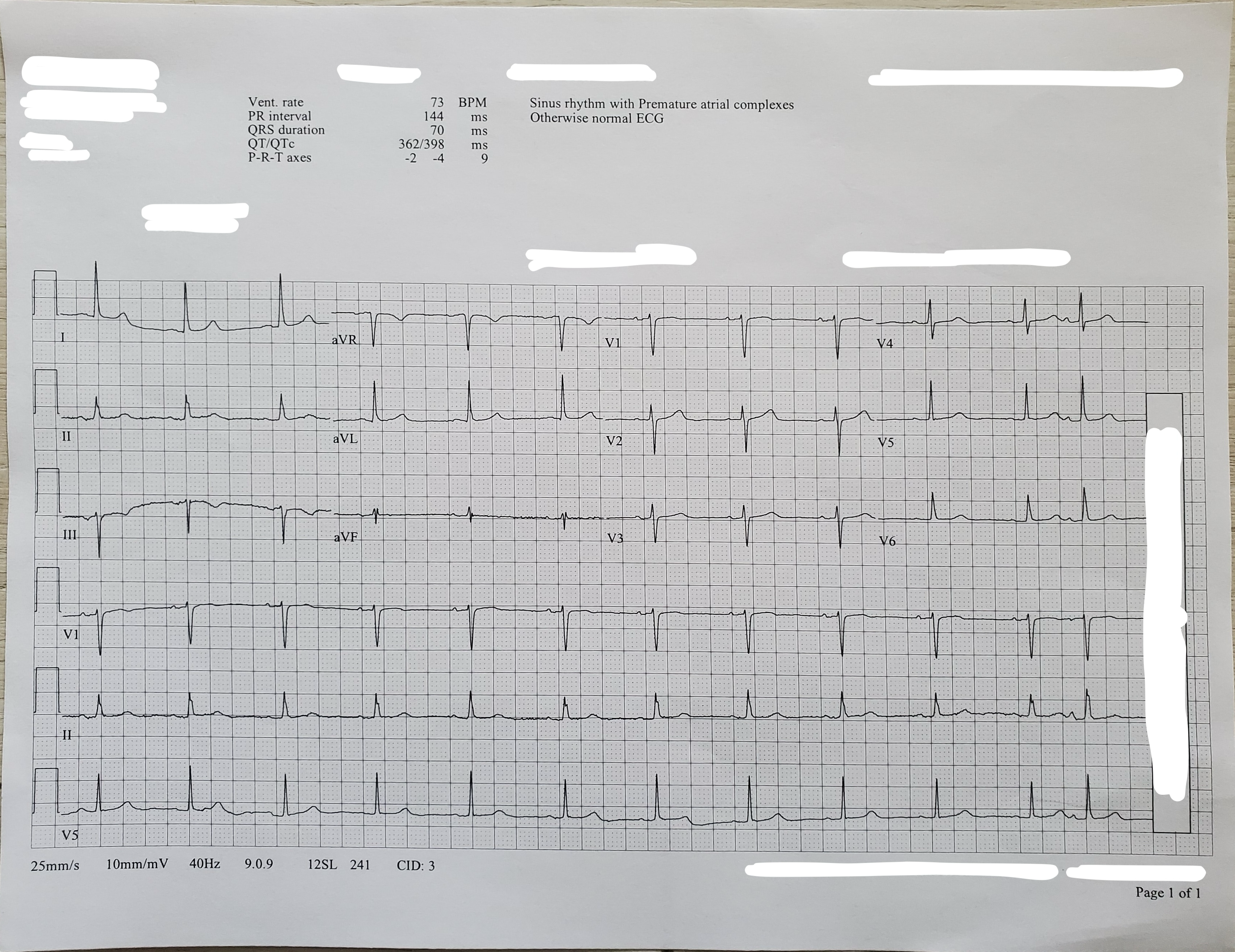Example of an ECG image.