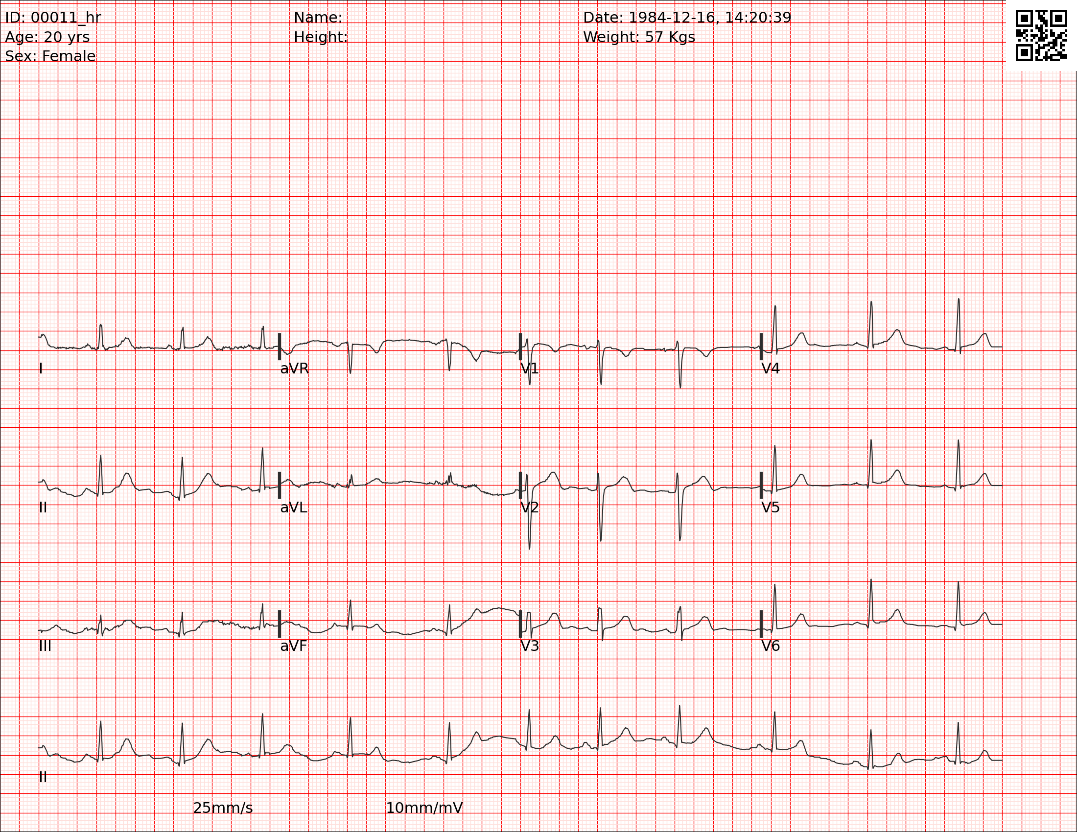 Example of an ECG image.