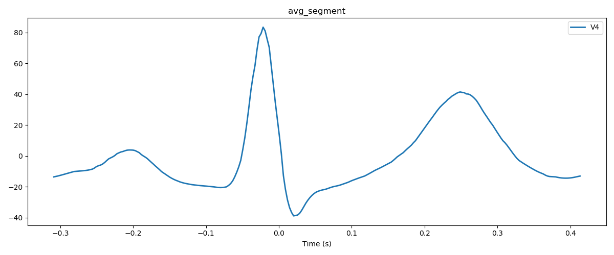 avg_segment_v4.png