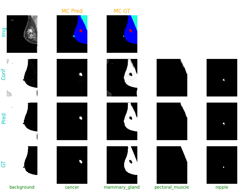 DM_segmentation_figure.png