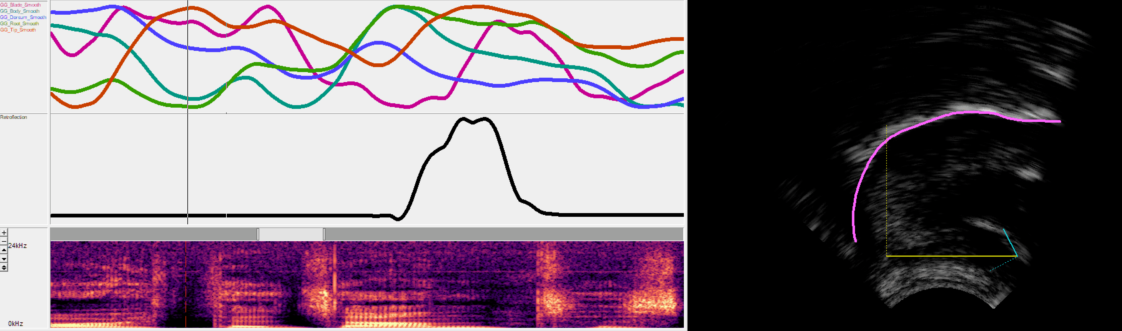 Animation showing multiple charts of analysis values which each show changing ultrasonic data over time