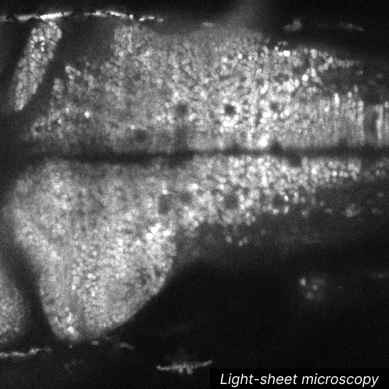 Light-sheet microscopy image deconvolution
