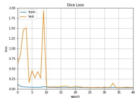 Lung mask training loss curve.jpg