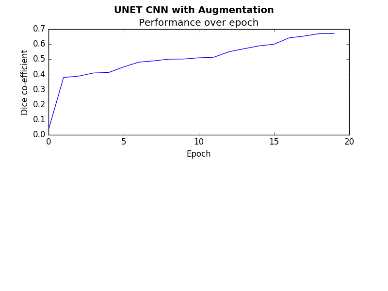 UNETSimple20Augmented.png
