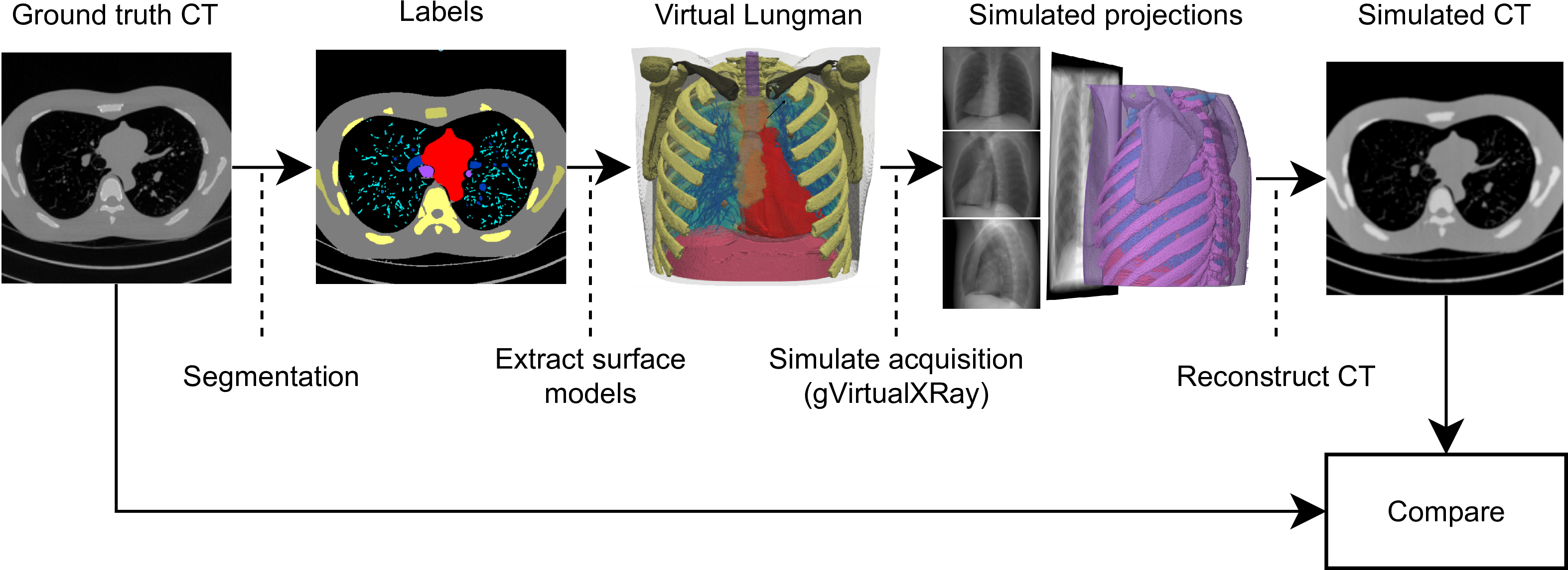 gVirtualXRay_vs_CT-crop.png