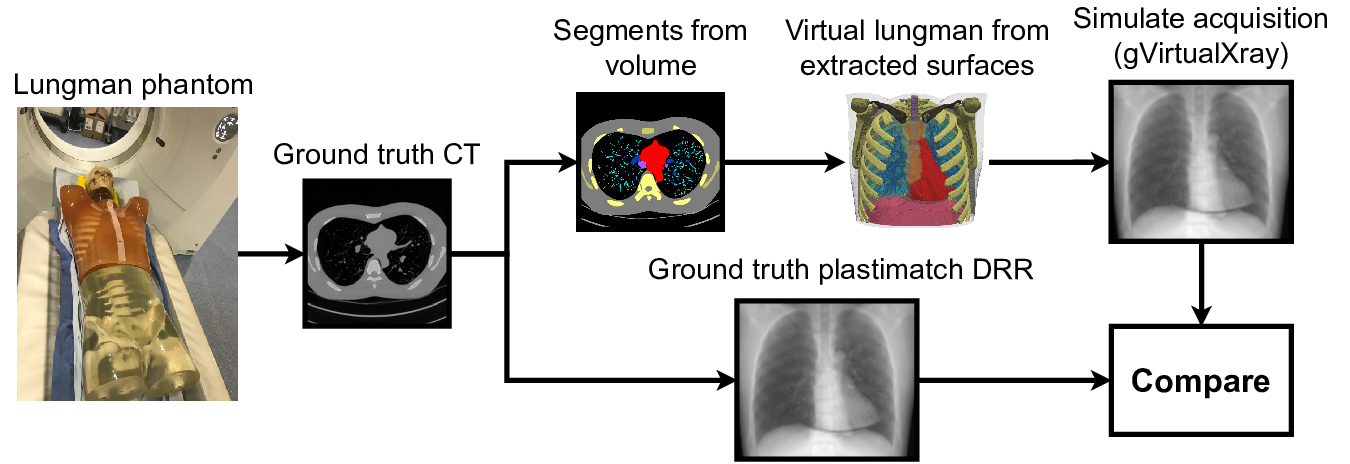 gvxr-flow-lungman-revised.png