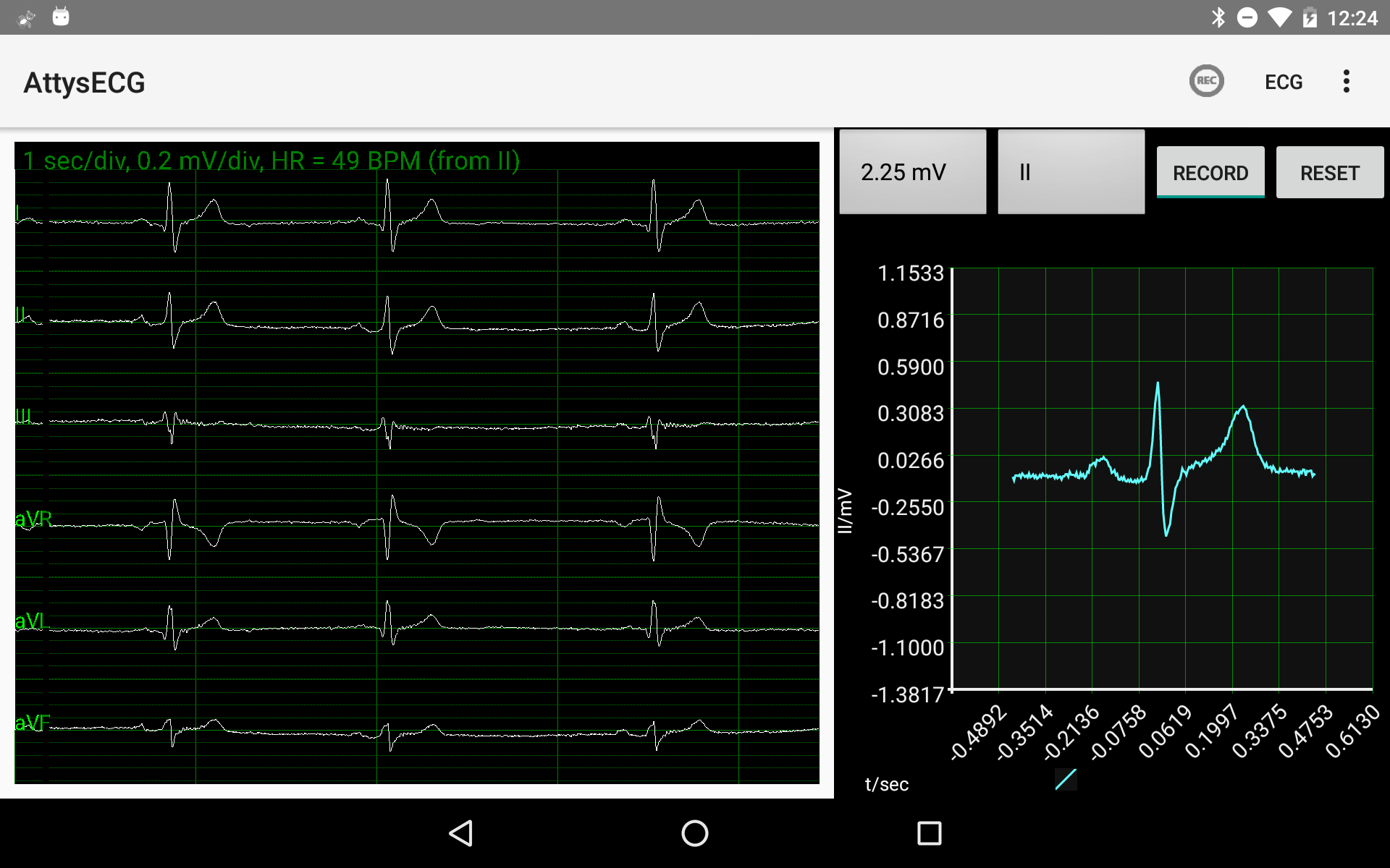 ecg-inspector-04.png