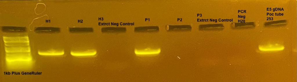 DreamTaq PCR Results
