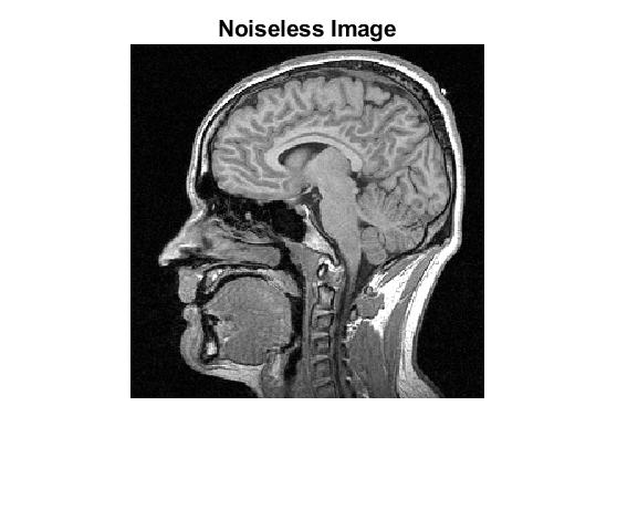 noiseless.jpg