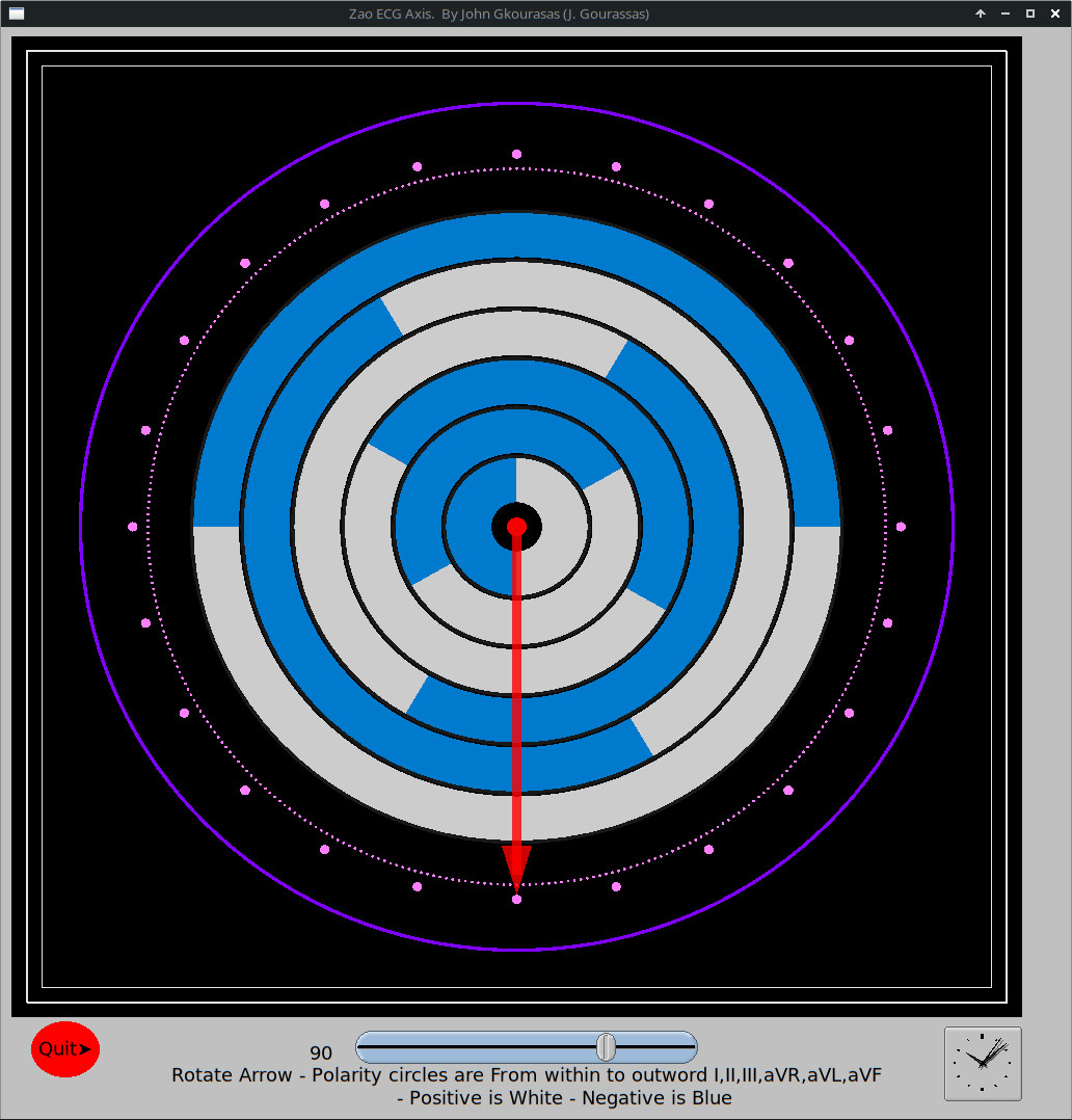 zao_ecg_axis.jpg