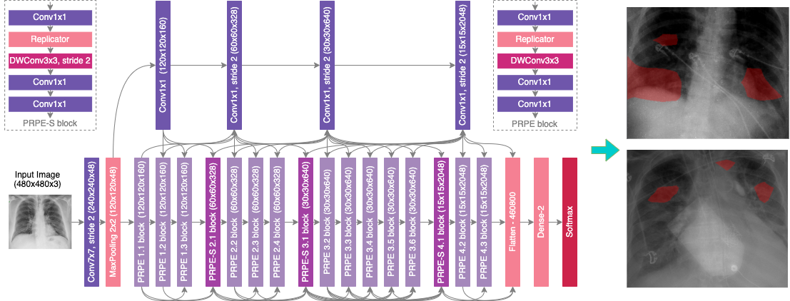 covidnet-cxr-2.png