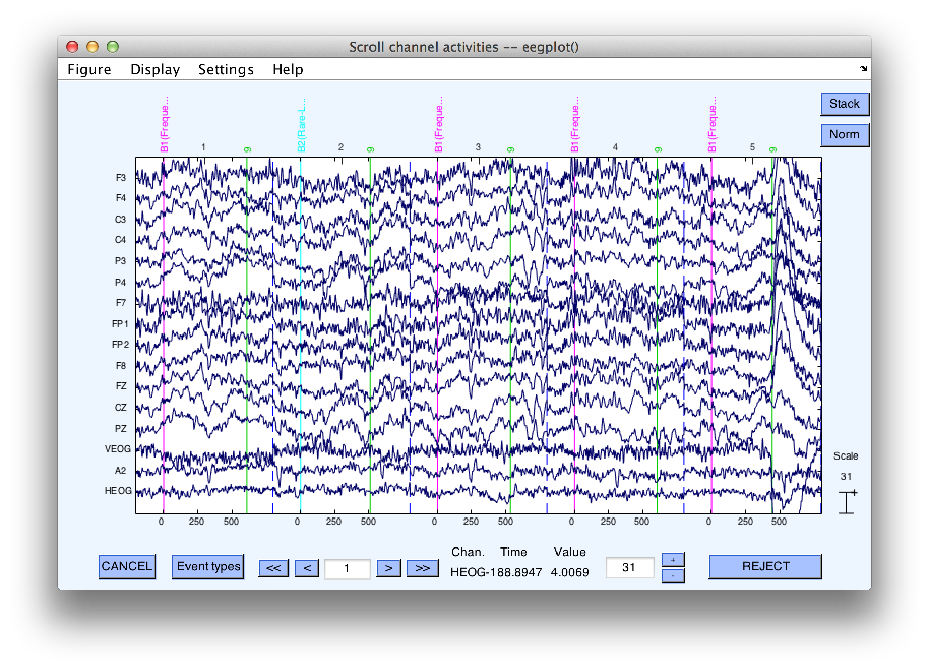 Creating Bin Based EEG Epochs Tutorial Lucklab erplab GitHub Wiki