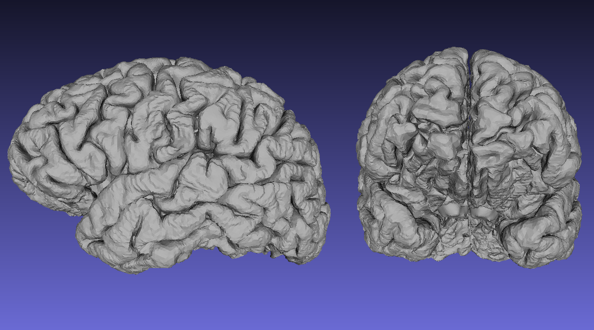 cortical_rough.png