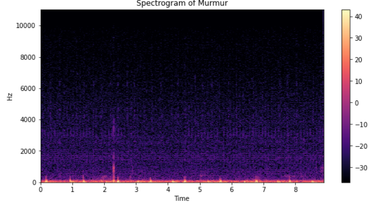 murmur_spectogram.PNG