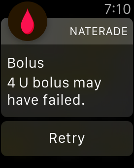 Watch Notification Bolus Failure.png