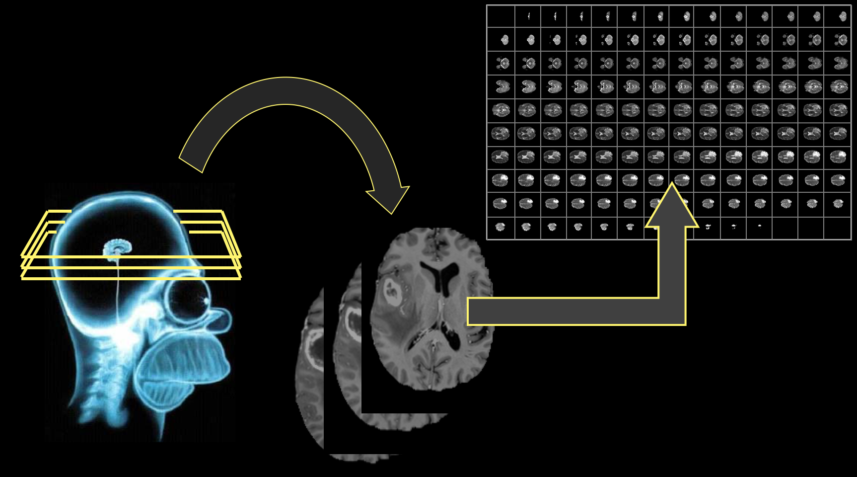 MRI_workflow.png