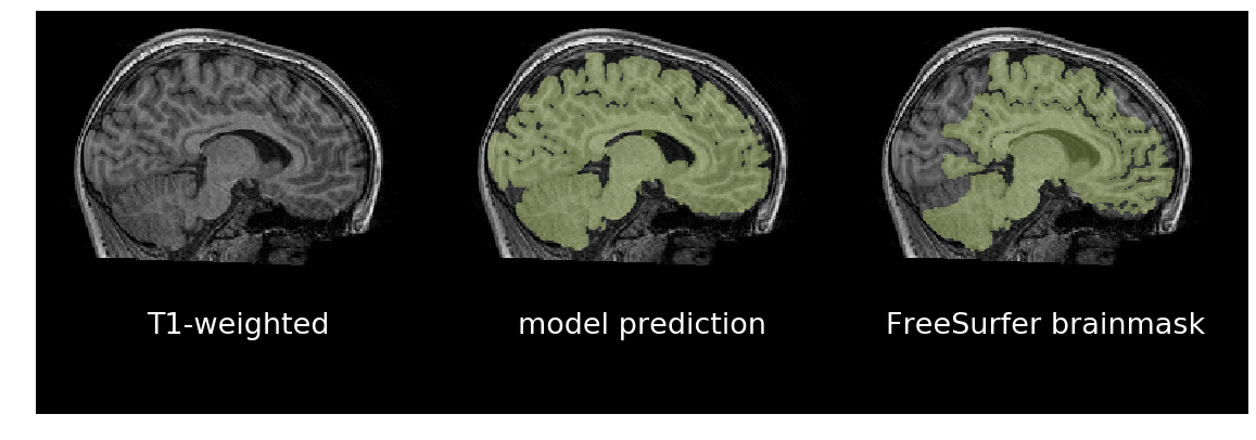 Model's prediction of brain mask