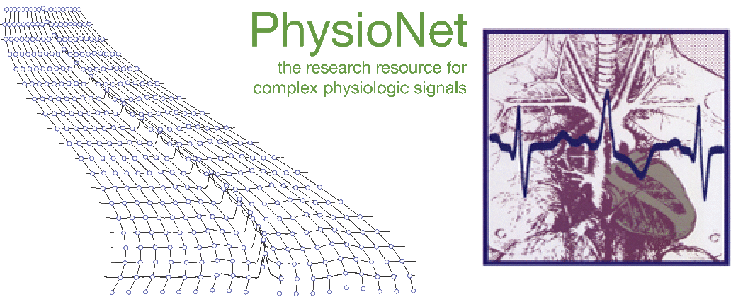 physionet-cinc.gif