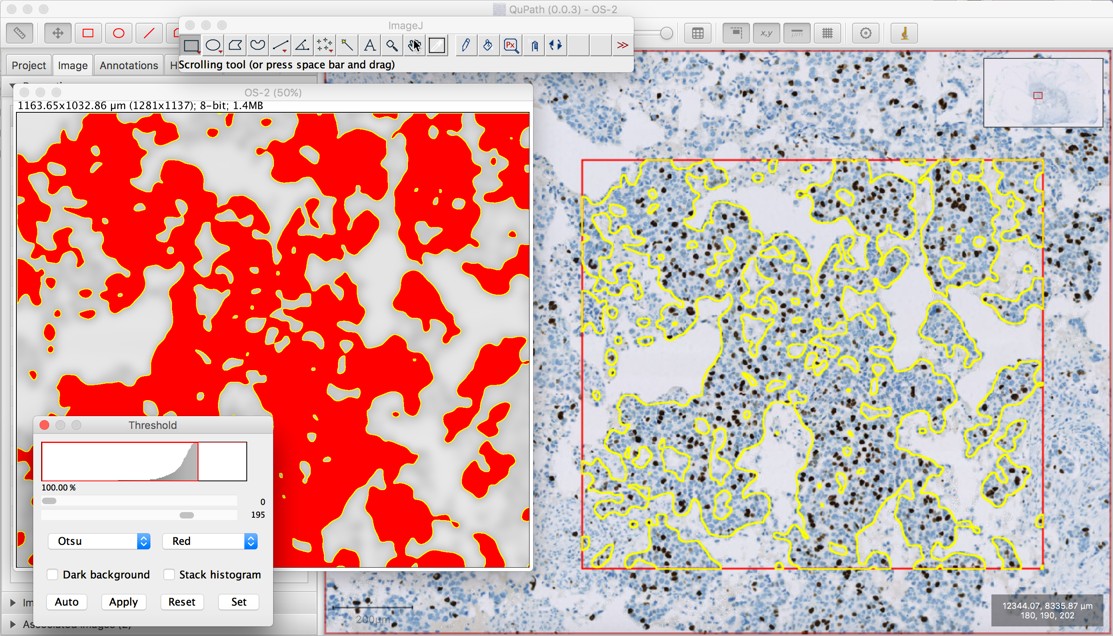 Sending a ROI from ImageJ to QuPath