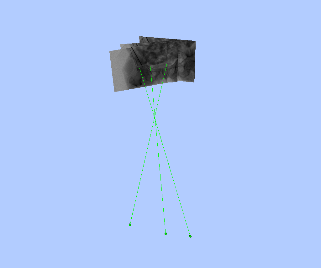 Example 1 X-ray Scene Image Overlay 1