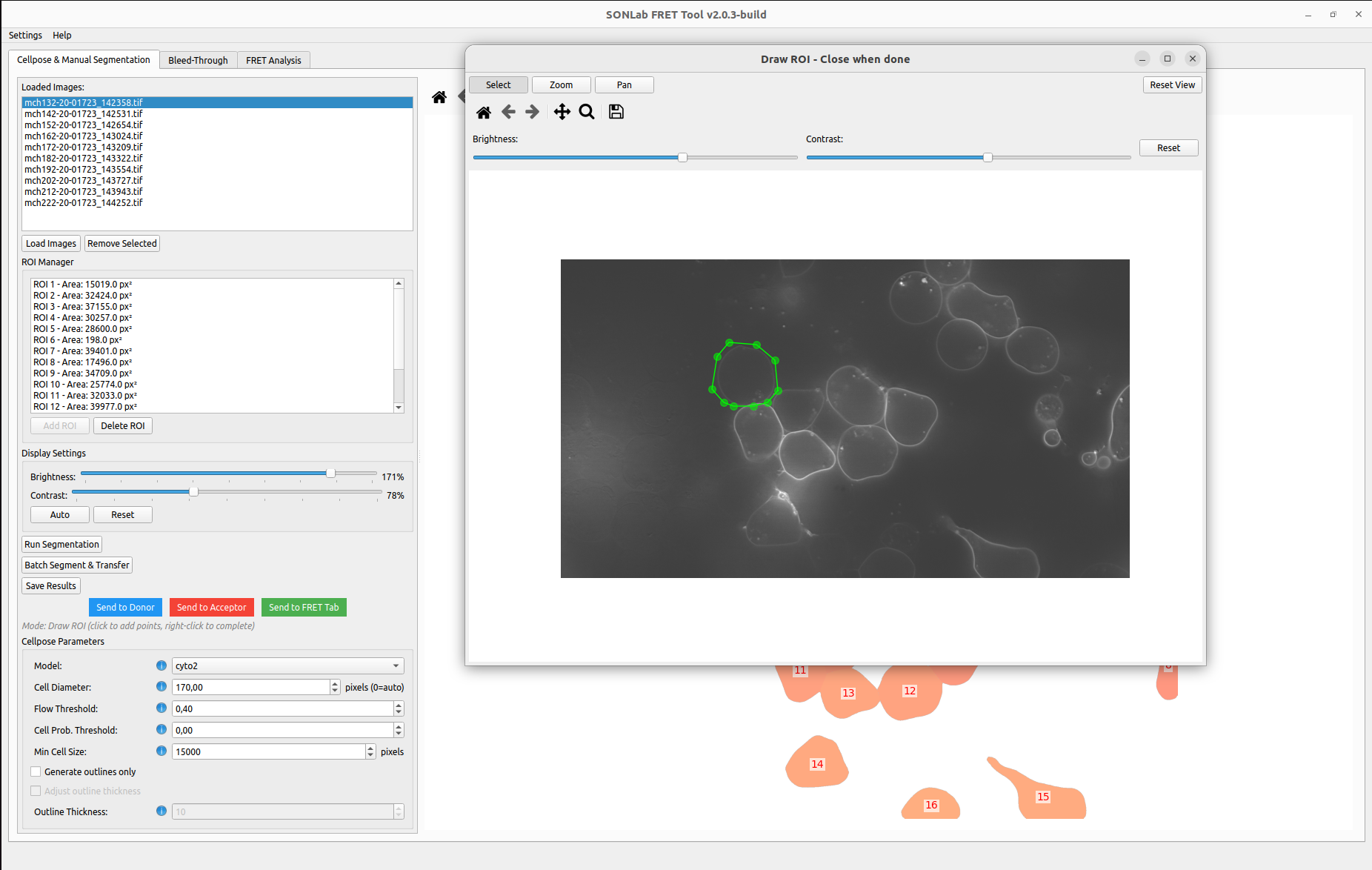 Drawing a polygon ROI in the ROI editor