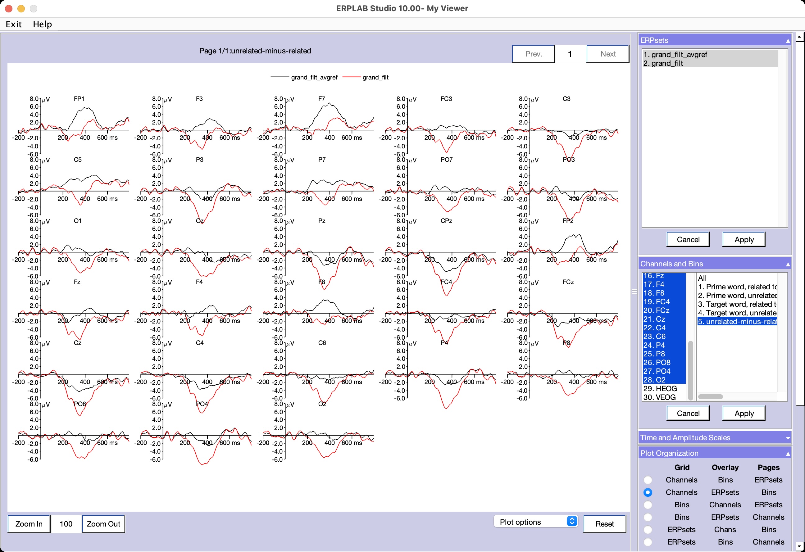 Studio Tutorial: Rereferencing with Channel Operations - ucdavis/erplab ...