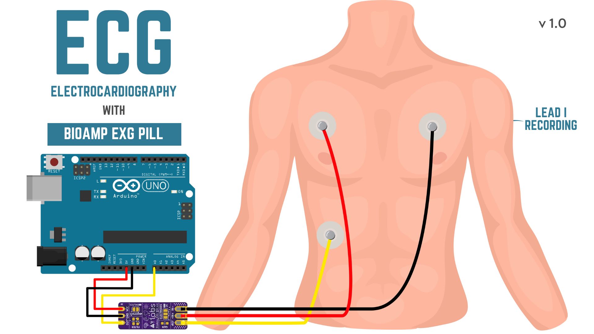 ECG.jpg