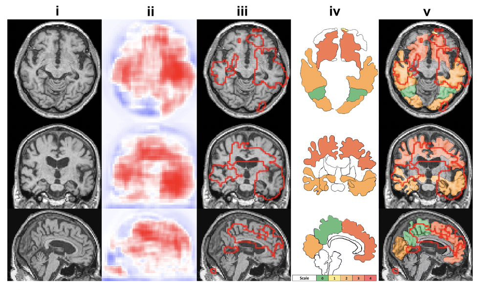 neuropath.png