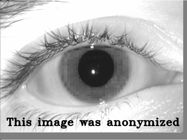 anonymized input image